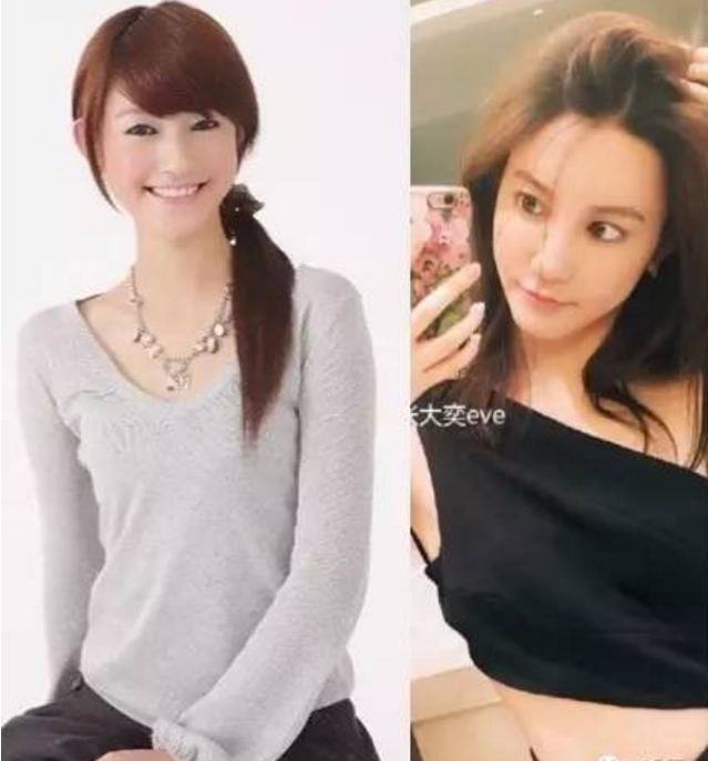 張大奕整容前后對比圖